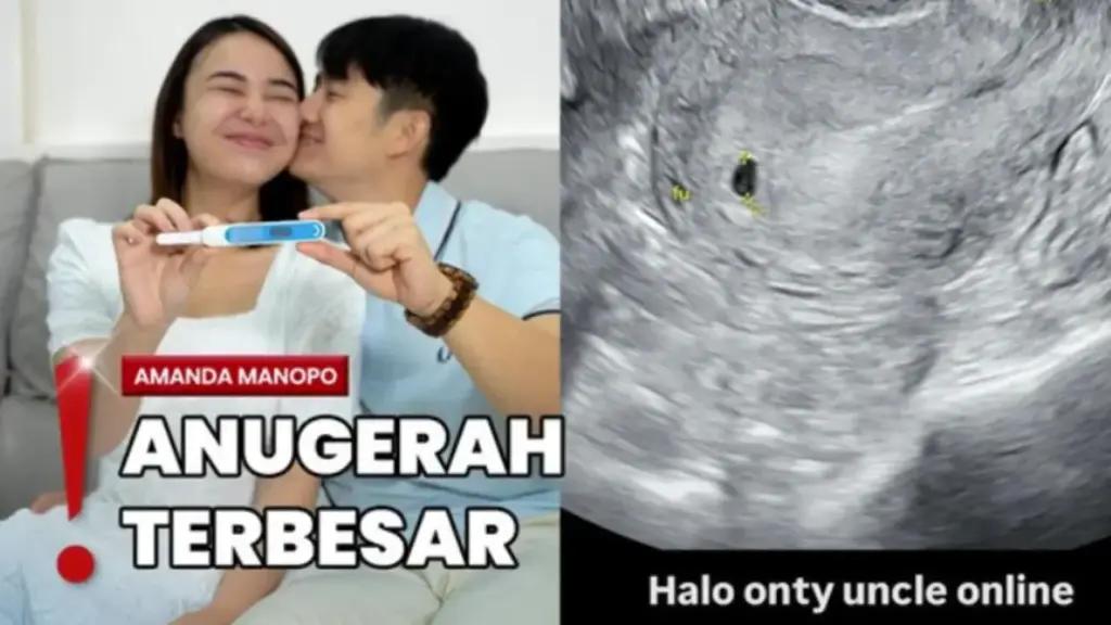 Amanda Manopo Hamil Pamer Hasil Test Pack