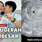 Amanda Manopo Umumkan Hamil Anak Pertama dengan Kenny Austin