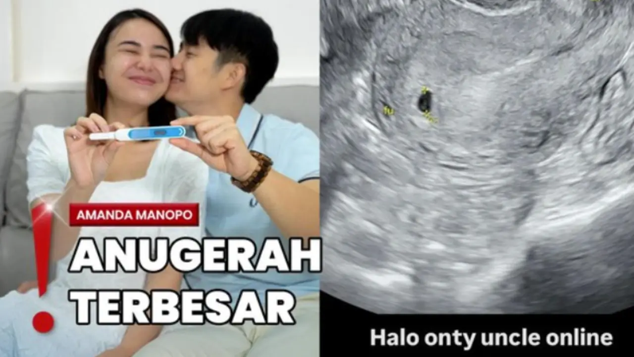 Amanda Manopo Umumkan Hamil Anak Pertama dengan Kenny Austin